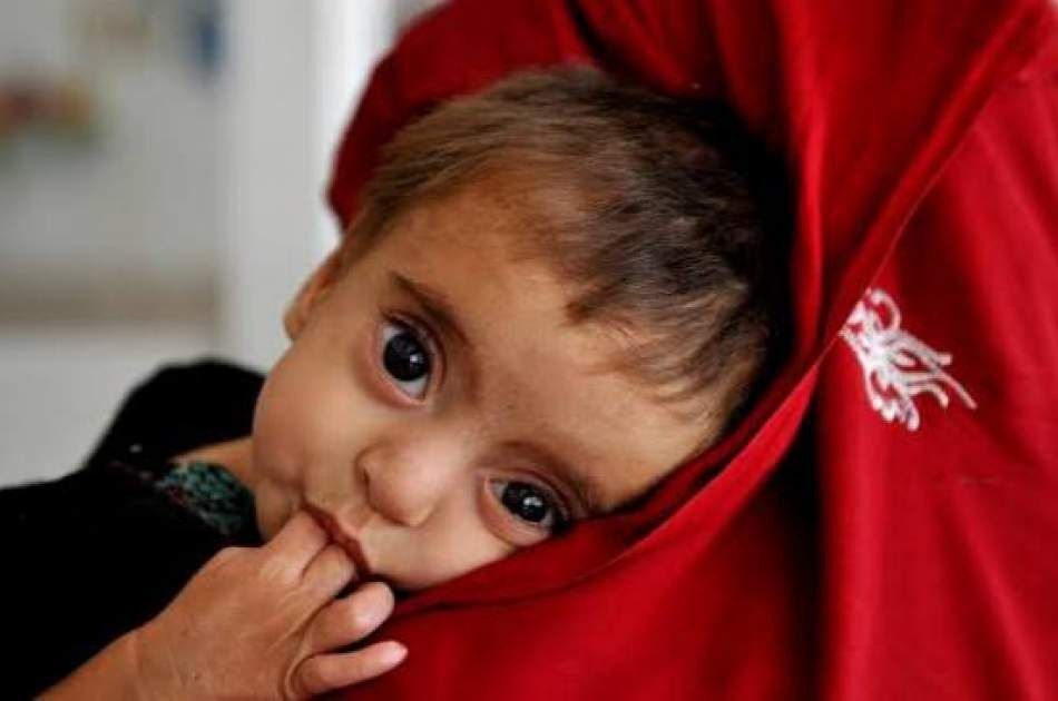 هشدار هماهنگ نهادهای بینالمللی؛ ۹۰ درصد کودکان افغانستان در فقر غذایی