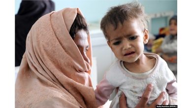 افزایش روزافزون کودکان مبتلا به سوء تغذیه در کابل