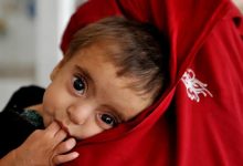 آغاز اجرای رهنمود ملی مدیریت سوءتغذیه حاد در افغانستان