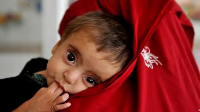 آغاز اجرای رهنمود ملی مدیریت سوءتغذیه حاد در افغانستان