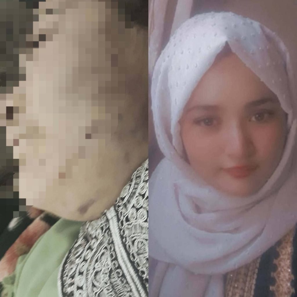 قتل فجیع محدثه در دایکندی؛ روایت تکان‌دهنده خشونت بی‌پایان خانوادگی