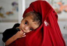 سازمان‌ملل؛ در سال 2026: سوء تغذیه نزدیک به 4 میلیون کودک را در افغانستان تهدید می‌کند