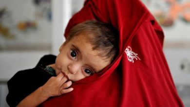 سازمان‌ملل؛ در سال 2026: سوء تغذیه نزدیک به 4 میلیون کودک را در افغانستان تهدید می‌کند