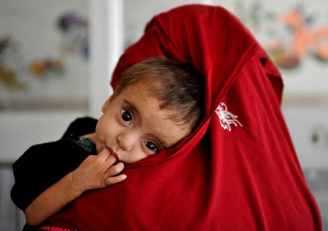 سازمان‌ملل؛ در سال 2026: سوء تغذیه نزدیک به 4 میلیون کودک را در افغانستان تهدید می‌کند