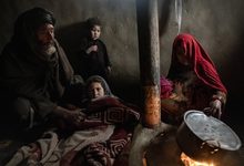 یونیسف: بیش از چهار میلیون کودک در افغانستان در سال ۲۰۲۷ به درمان سوءتغذیه نیاز خواهند داشت